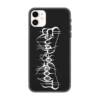 Woods of Ypres iPhone Case, Woods of Ypres Artwork iPhone 16 Phone Case
